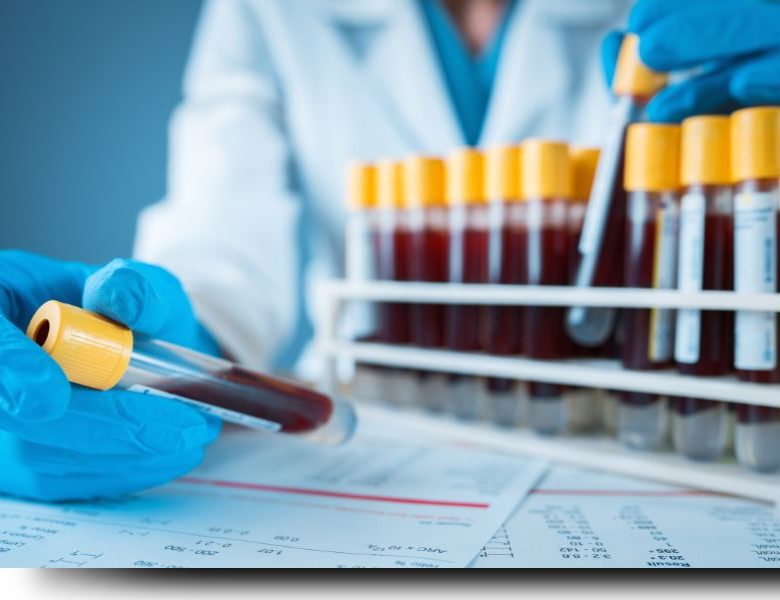 Tubos de exámenes de sangre: ¿Qué son y para qué sirven?